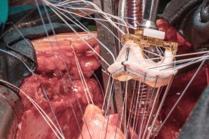 Safety Assessment of Styrene-Based Copolymers for Cardiac Valve Applications: Six-Month Outcomes in a Juvenile Sheep Model